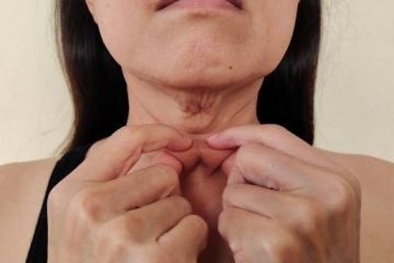 How To Treat Neck Wrinkles? 6 Effective Ways to Treat Them